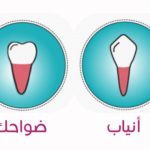 انواع الاسنان