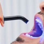 الحشوات الضوئية للأسنان