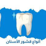 أنواع قشور الأسنان