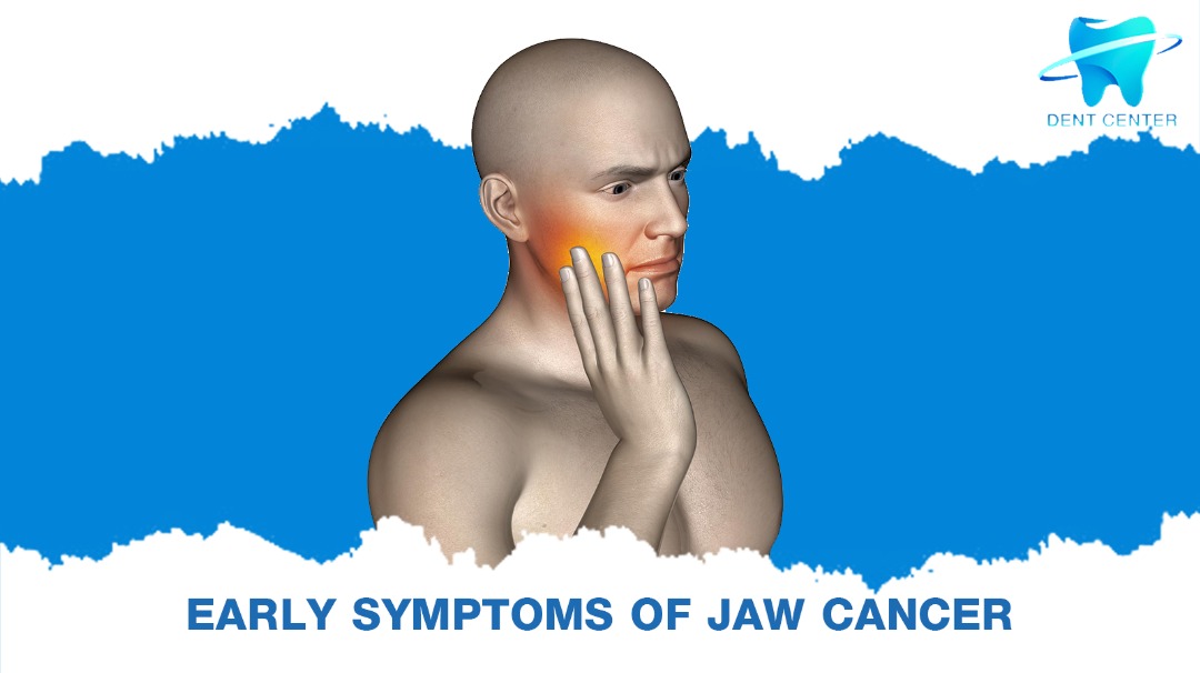 Early Symptoms of Jaw Cancer - DentCenterTurkey