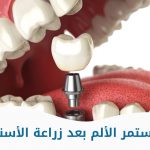 كم يستمر الألم بعد زراعة الأسنان؟