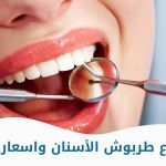 أنواع طربوش الأسنان واسعارها