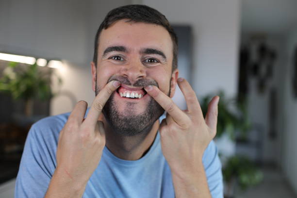 علاج تراجع اللثة بالليزر