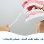 هل يمكن إيقاف التآكل الحمضي للأسنان؟