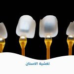 تغشية الاسنان