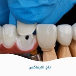 تاج الايماكس