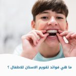 ماهي فوائد تقويم الاسنان للاطفال؟