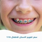 سعر تقويم الأسنان للاطفال 2025