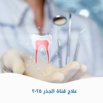 علاج قناة الجذر ٢٠٢٥