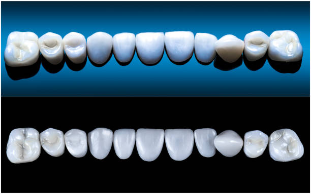 الفرق بين الزيركون والايماكس