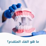 ما هو الفك المتقدم؟