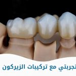 تجربتي مع تركيبات الزيركون