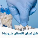هل تيجان الأسنان ضرورية؟