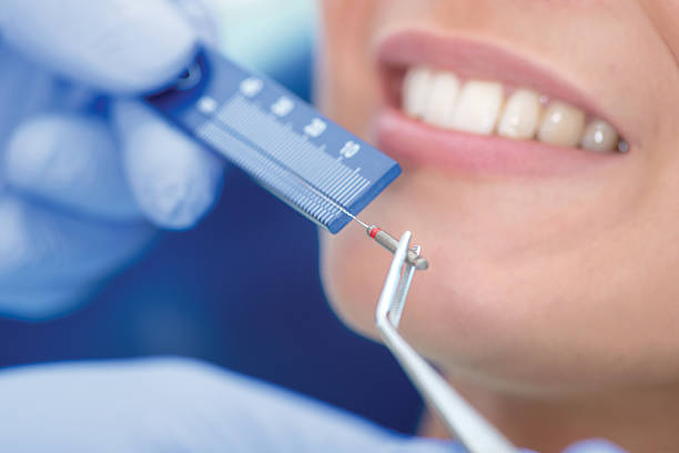 طب حشو الأسنان 