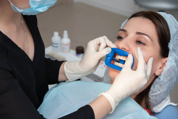 أفضل طرق تبييض الأسنان الطبية