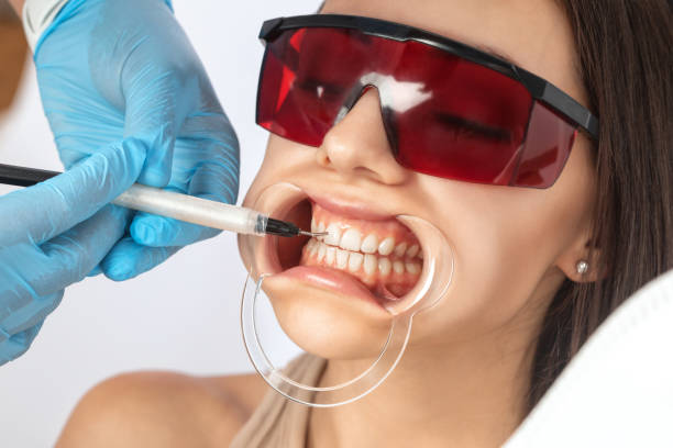 Best Medical Teeth Whitening Methods