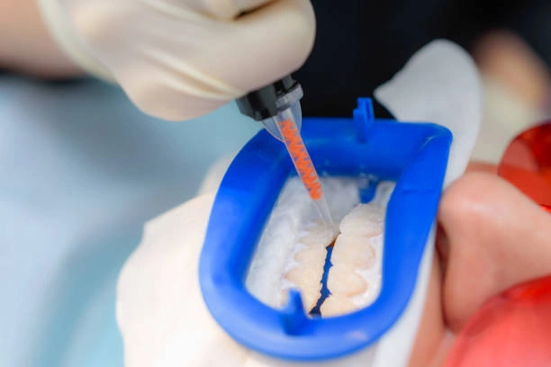 ترميم الكسور الصغيرة باستخدام Resin Injection