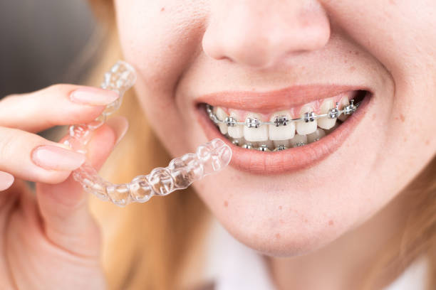 Orthodontics for Children