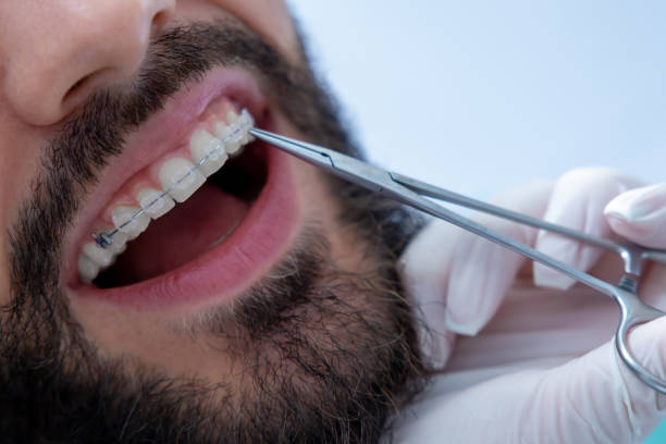 Orthodontics in Turkey