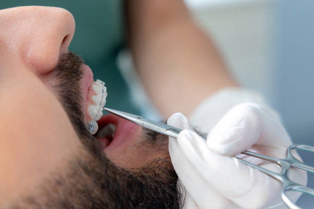 Treatment Duration for Adults