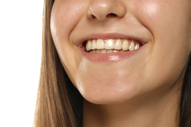 تركيب الزيركون الشفاف (Translucent Zirconia)