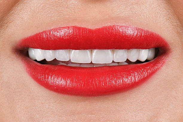 Before and after Hollywood Smile