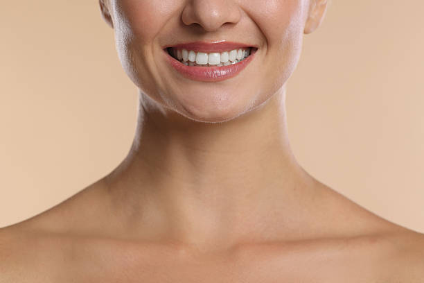 Hollywood Smile cost in Turkey