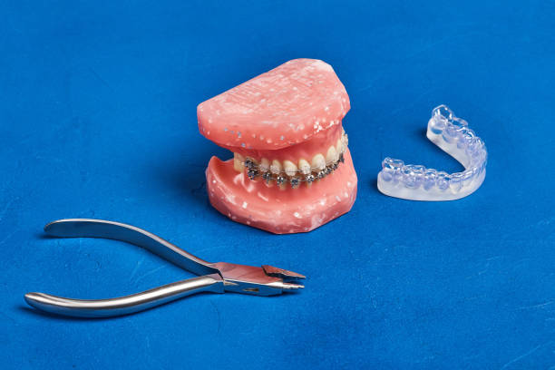 Types of Orthodontics in Turkey