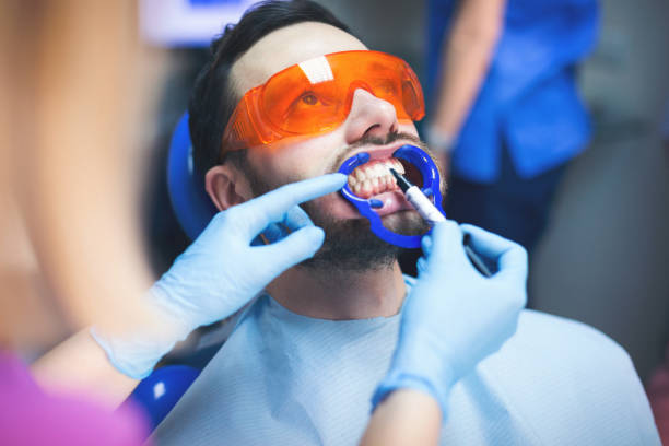 تبييض الأسنان في تركيا