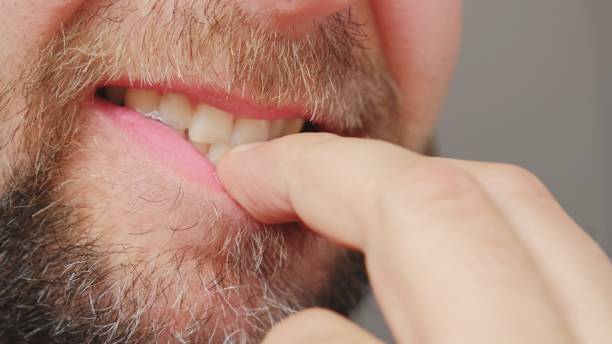 سبب اصفرار الأسنان عند الأطفال